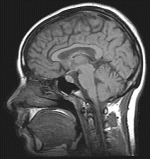 MRI_brain_150.jpg